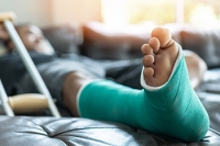 Managing a Broken Foot